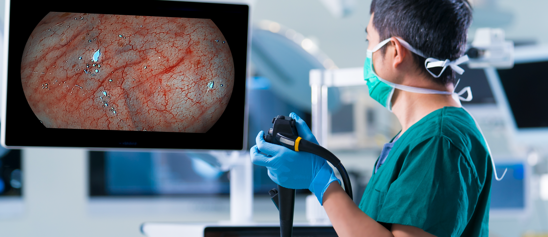 gastrointestinal endoscope