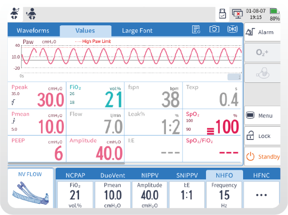 infant ventilator